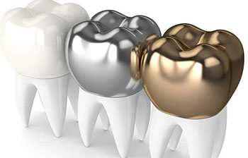 turkey-dental-crowns