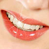 dental-implants-in-turkey